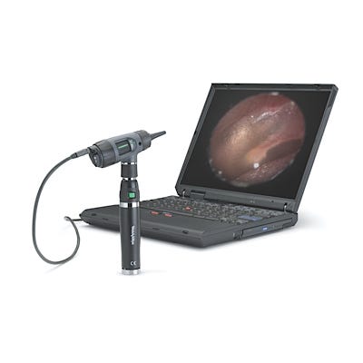 Welch Allyn Digital MacroView