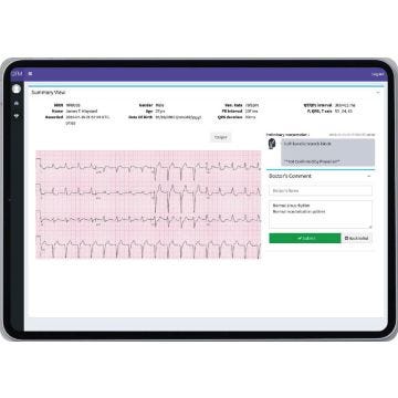 Tablet with white screen depicting an ECG with red lines plus black lines to show heartbeat.