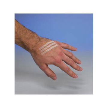 Front view of person wearing Leuokostrips on their hand