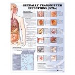 Sexually Transmitted Infections Anatomical Chart