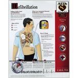 Understanding Defibrillation Poster, 14" x 20", Laminated