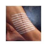steri strips, 3m steri strips, steristrips